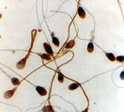 spermatozoides