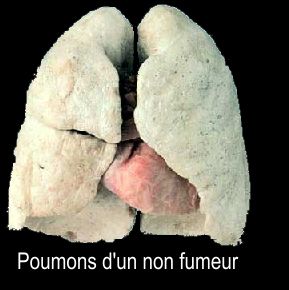 poumon-de-non-fumeur