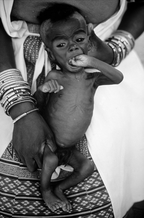 eve-arnold-south-africa-malnutrition-bébé