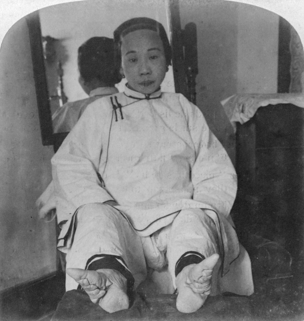 Chine-Pieds-Bandés